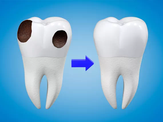 ząb przed i po leczeniu